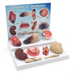 Small models of brain, eye, heart, artery, kidney and pancreas, neuron and foot to show the affects from diabetes. 
