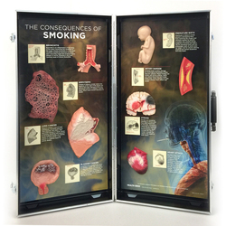 display shows diseases and conditions that can result from smoking. 