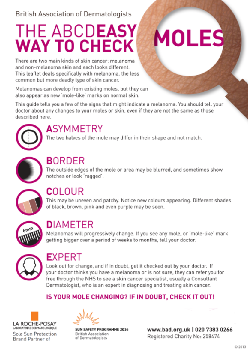 The poster guide shows a magnifying glass listing what the ABCDE stands for with a brief description for each sign
