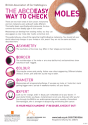 The poster guide shows a magnifying glass listing what the ABCDE stands for with a brief description for each sign 